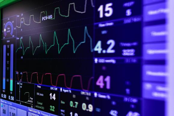 Electrocardiogramme